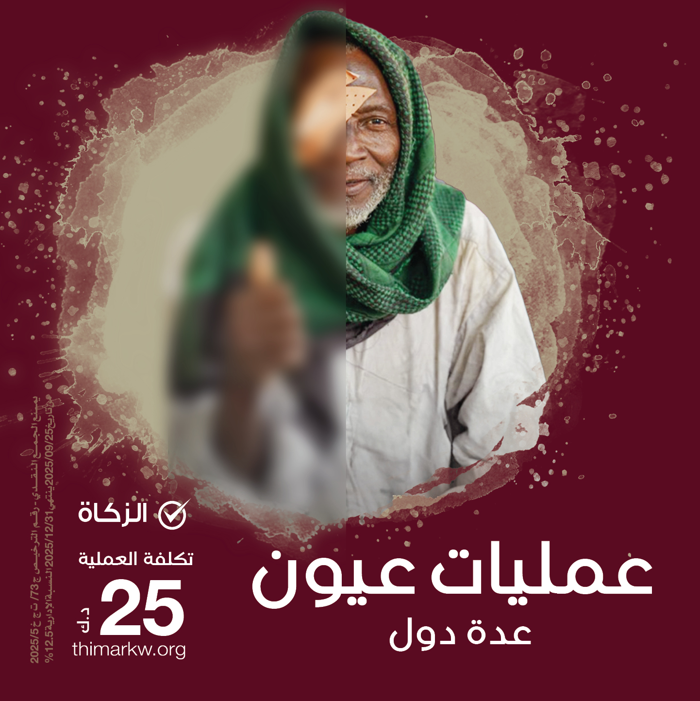 صورة عمليات عيون 