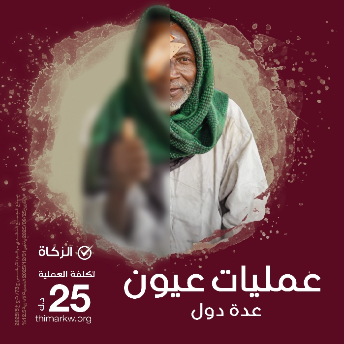 صورة عمليات عيون 